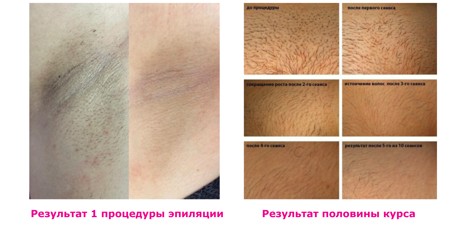 для сайта 2 (3).png