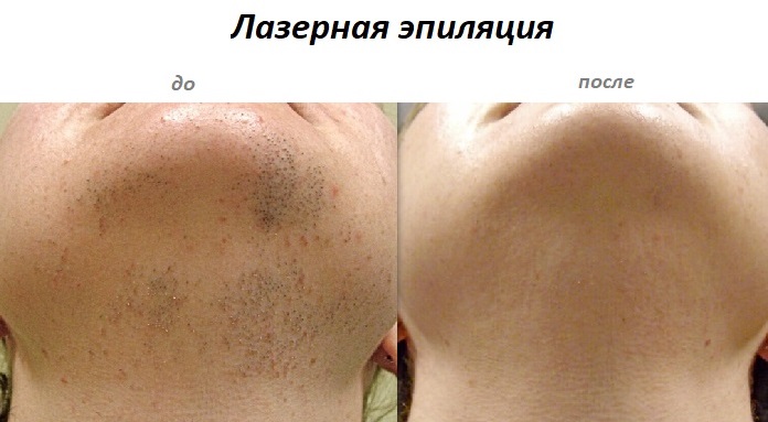 до-после — копия.jpg до-после — копия.jpg