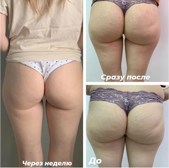 Снимок экрана 2023-01-25 110950.png