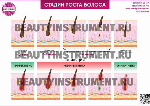 Купить Плакат А3 для косметолога "Стадии роста волос и эффективность эпиляции" по цене 